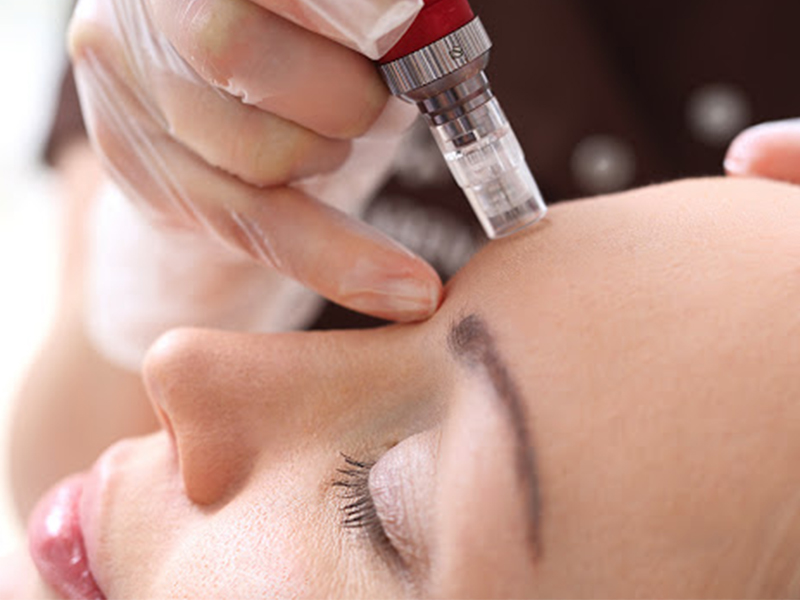 دوره آموزشی مزوتراپی (mesotherapy)